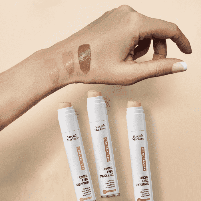 Conceal & Improve Appearance of Stretch Marks(Medium)