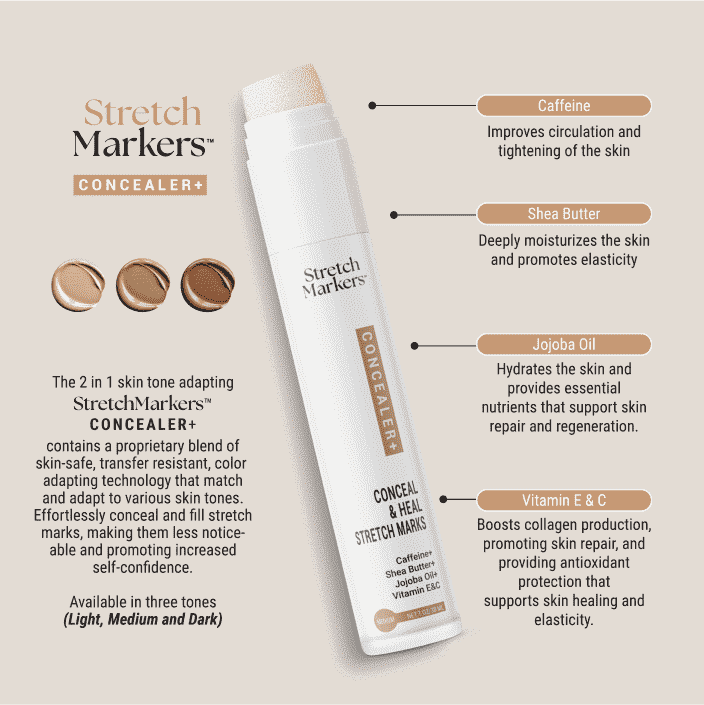 Conceal & Improve Appearance of Stretch Marks(Medium)
