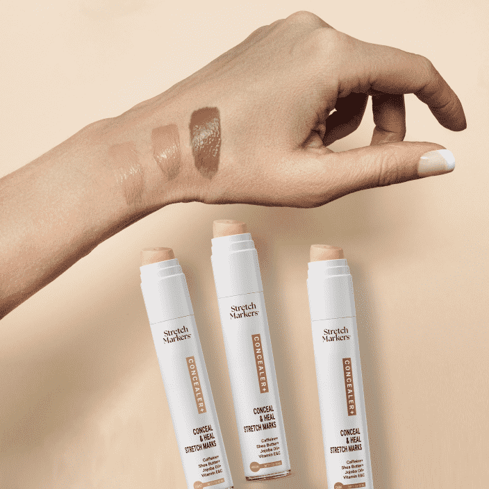 Conceal & Improve Appearance of Stretch Marks(Light)